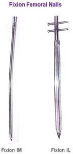 Fixion Femoral Nail, Femoral Nails