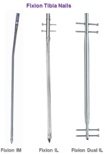 Tibia nail